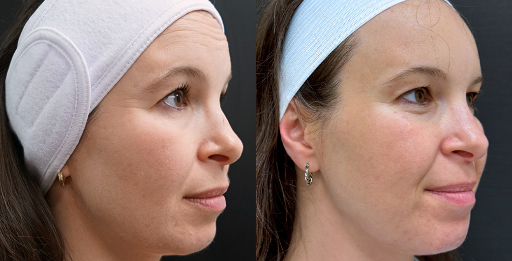 Before - and -After - RadiantTrio - 001