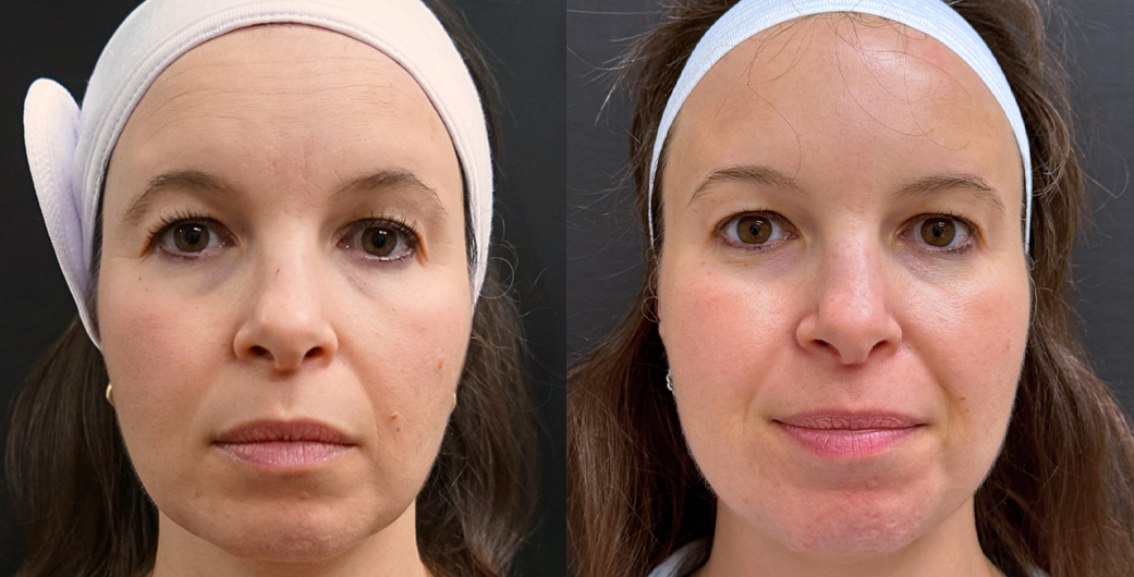 Before - and -After - RadiantTrio - 002