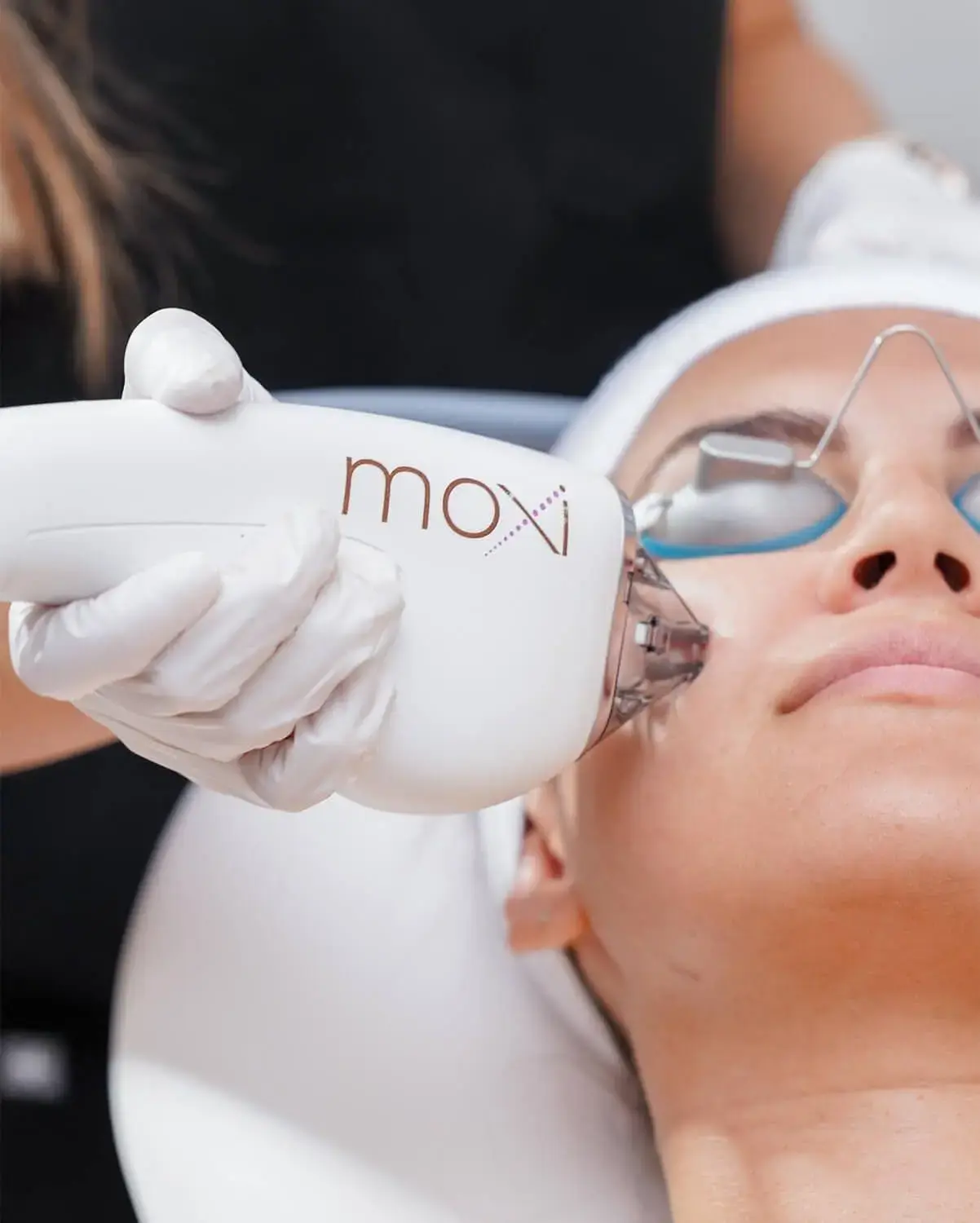 laserfacials-40off